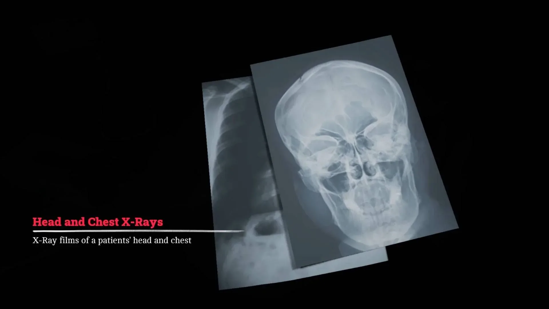 Silent Hill Townfall x-ray puzzle